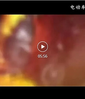 电动车火灾警示教育片10部之05