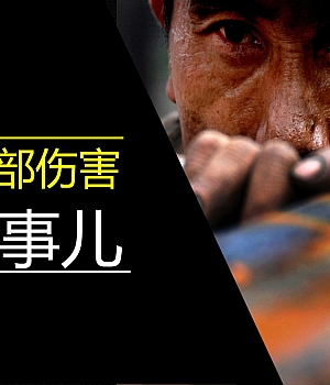 保护你的手手部事故预防那些事儿